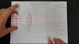 Vision Correction Normal Eyes Myopia Hyperopia Near amp Far Point Lens Power [upl. by Breger605]