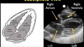 Ultrasound Guided Ankle Block [upl. by Leno]