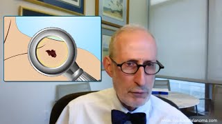 Surgeon explains melanoma surgery [upl. by Jesus]