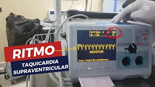 ADENOSINA CARDIOVERSIÓN FARMACOLÓGICA [upl. by Adnaluy]