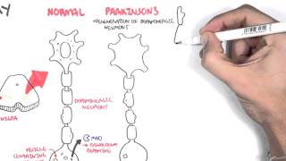 Pharmacology  Parkinsons Disease [upl. by Ecnerat]