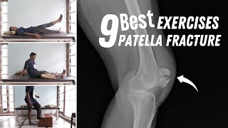 9 Best Patella Fracture Recovery Exercises after broken kneecap surgery [upl. by Olwen]