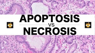 Apoptosis Intrinsic Extrinsic Pathways vs Necrosis [upl. by Rodrigo]