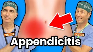 What Causes Appendicitis amp How to Treat It [upl. by Yetnruoc393]