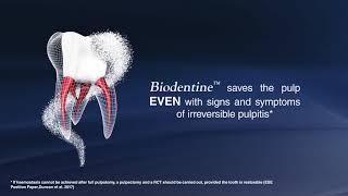 Biodentine  REVERSE THE IRREVERSIBLE [upl. by Auqined]