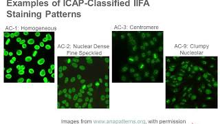 Antinuclear Antibody Testing [upl. by Airdnal]