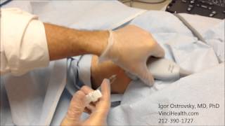 Hyaluronic Acid Injection to the Knee Joint 1 [upl. by Havard]