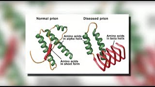 Bacterial Meningitis CNS Infection – Infectious Diseases  Lecturio [upl. by Tnairb]