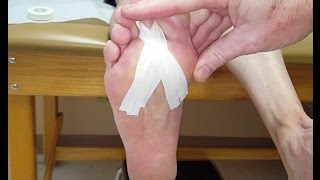 Plantarflexion Taping for Plantar Plate Tears [upl. by Porta736]