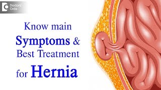 What is Hernia Symptoms Causes Types Treatment  Dr Harish N S  Doctors Circle [upl. by Lorelie]