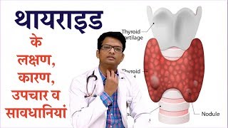 Thyroid disease causes symptoms amp treatment  थायराइड के लक्षण कारण उपचार व सावधानियां [upl. by Eicnan]