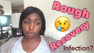 Post Myomectomy Surgery  Road to Recovery  Allthingslatoya [upl. by Carl]