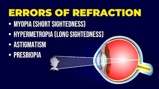 Errors of Refraction  Myopia  Hypermetropia  Astigmatism  Presbiopia  Short amp Long Sightedness [upl. by Unders]