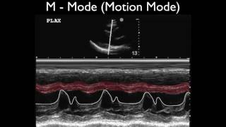 Ultrasound Physics Scanning Modes M Mode [upl. by Trela8]