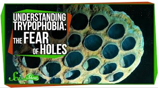 Understanding Trypophobia The Fear of Holes [upl. by Orlan471]