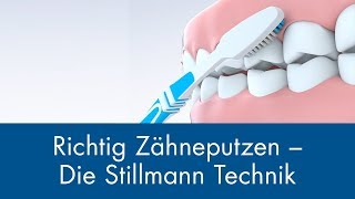 Richtig Zähneputzen  Die Stillmann Technik [upl. by Mond]