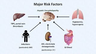 Hepatic Encephalopathy [upl. by Zacks]