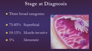 Bladder Cancer [upl. by Tenej]