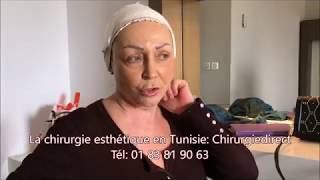 Chirurgie esthetique Tunisie lifting cervico facial à 66 ans [upl. by Emirej424]