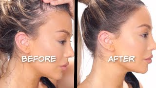 HOW TO FAKE A PERFECT HAIRLINE AND COVER BALD SPOTS  Dilan Sabah [upl. by Berck476]