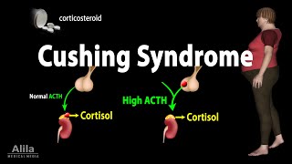 Cushing Syndrome Animation [upl. by Sachi]