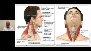 Neck lumps in general practice [upl. by Brigham180]