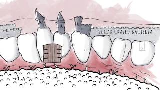 How Xylitol Works  Spry Dental Defense from Xlear [upl. by Bravar896]