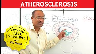 Atherosclerosis  Pathophysiology [upl. by Ettegirb]