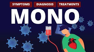 What is MONO Symptoms Diagnosis amp Treatments [upl. by Zobias]