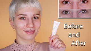 Avene Soothing Eye Contour Cream  Before amp After [upl. by Kelwin]