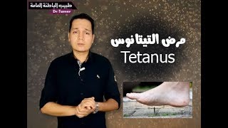 التيتانوس  Tetanus [upl. by Trauner673]