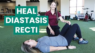 Exercises to Fix Your Diastasis Recti  Physical Therapy [upl. by Haraj]